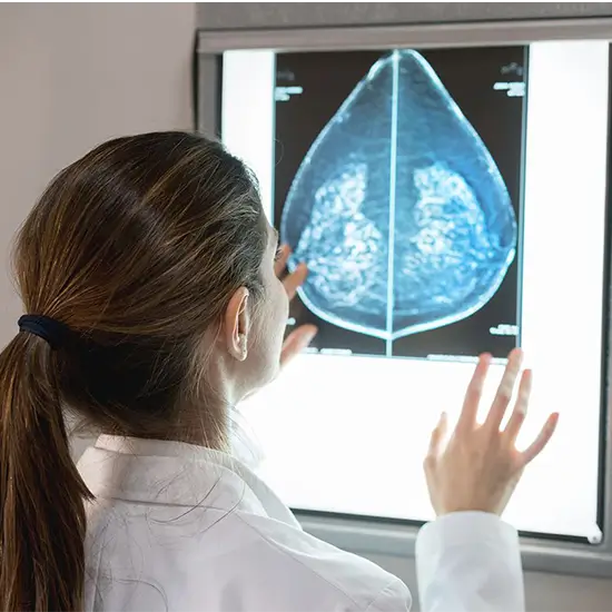 breast cancer ai assisted panel 4 test